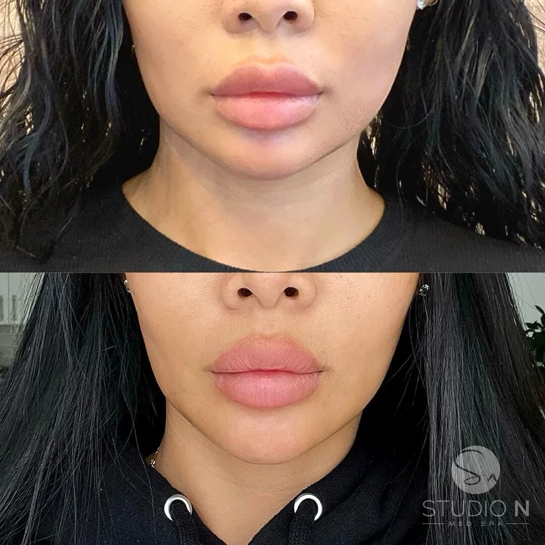 Appointments 3 — Studio N MedSpa