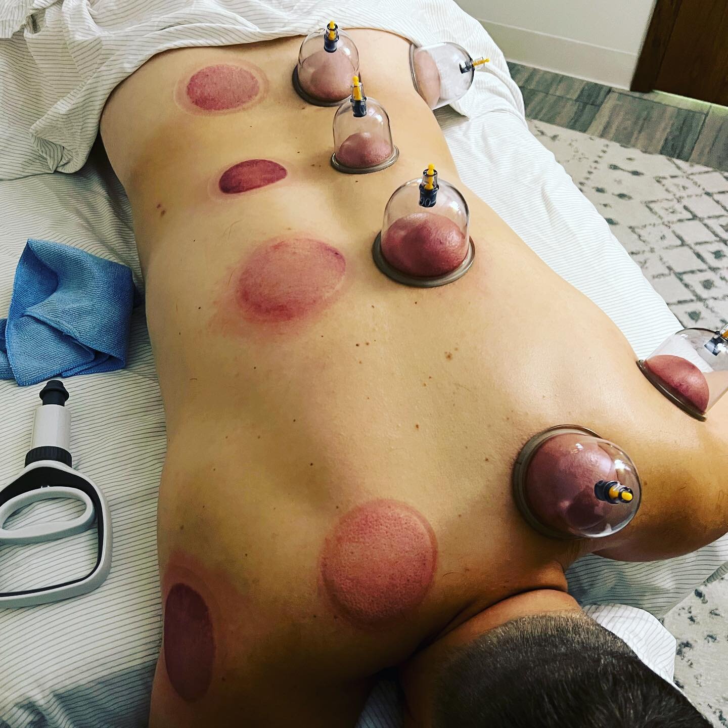Have you tried cupping? It&rsquo;s an great add-on to a massage to help release muscle tightness and relieve pain. Check out the link in my bio for booking. #massagetherapist #cupping #massagemke #brookfield #rrmassage #lmt #painrelief #bookwithme