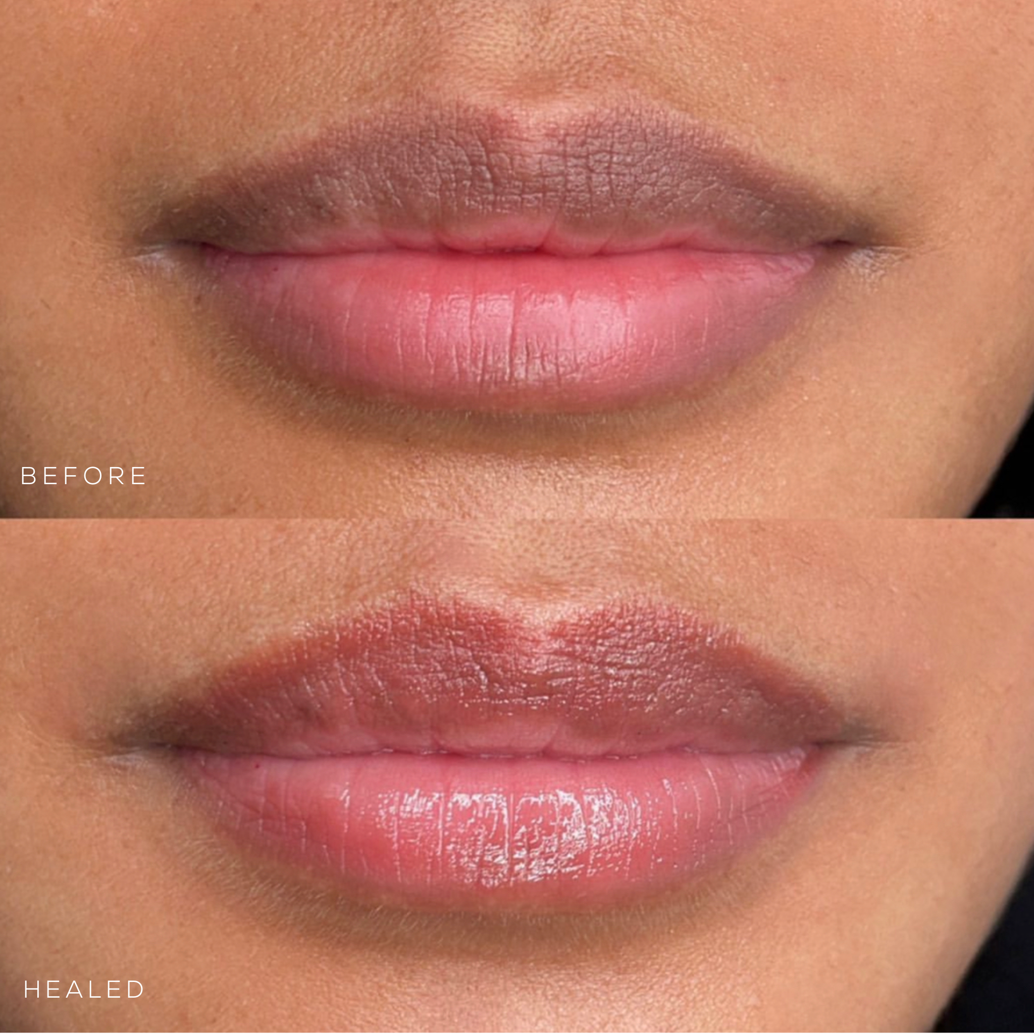 lips.PNG
