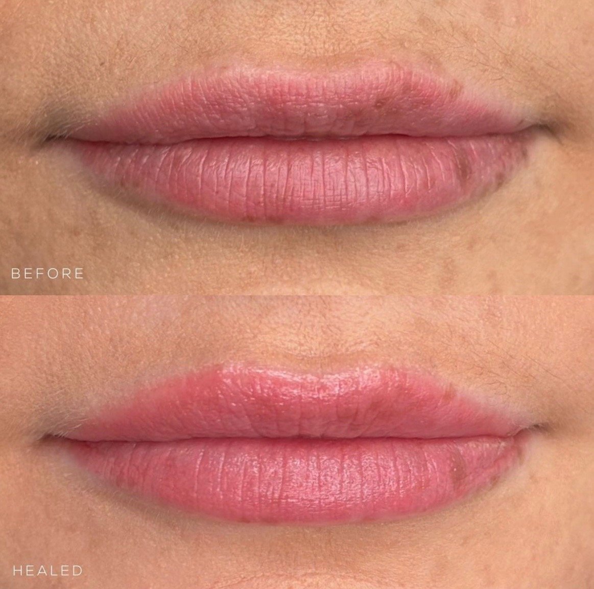 lip.jpeg