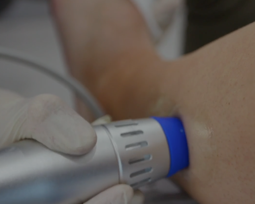 Shockwave Therapy