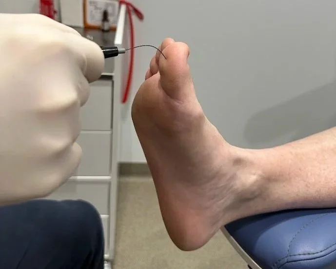 Diabetic Foot Assessment