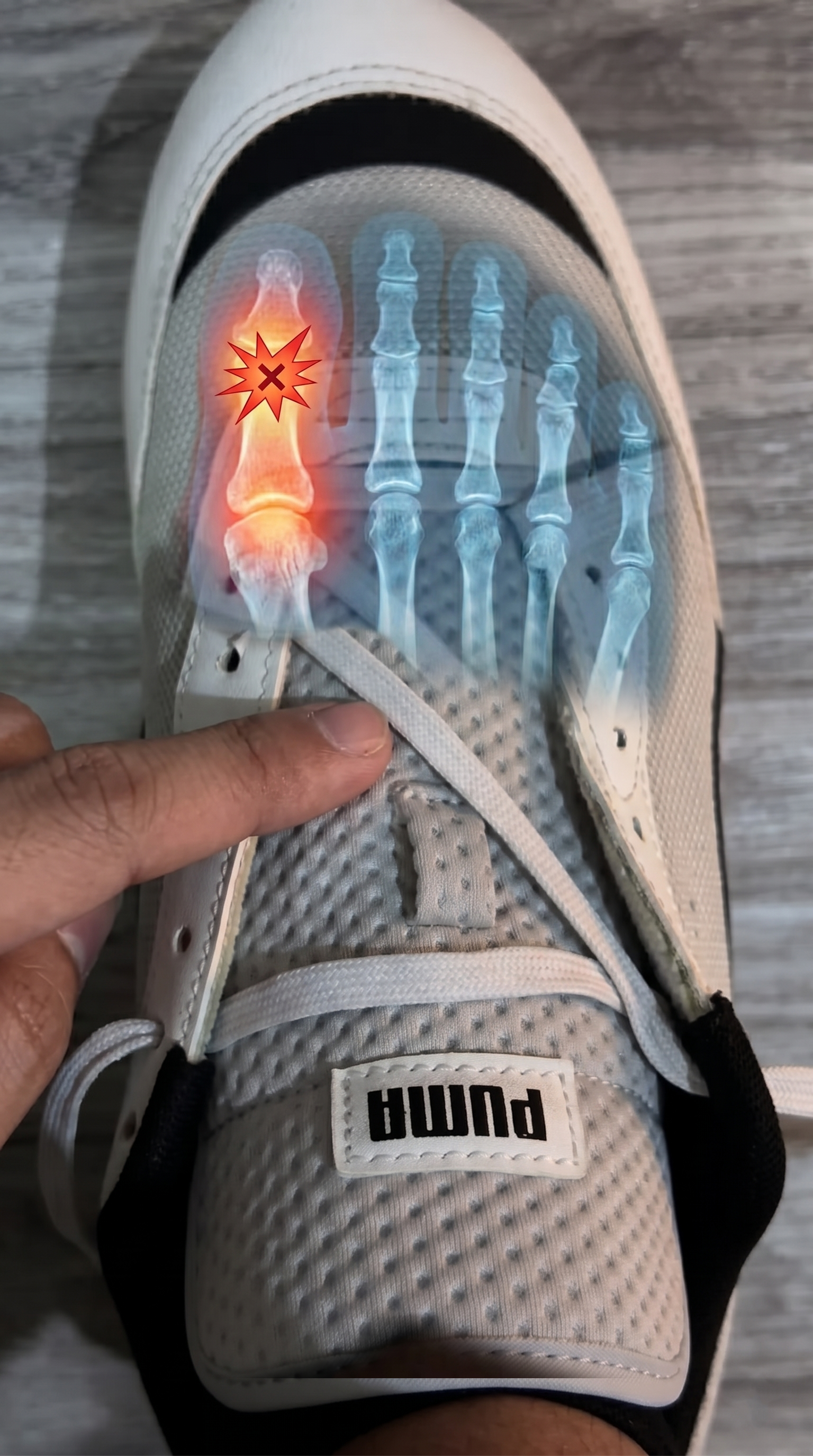 Single Helix Lacing: The Simple Trick That Could Relieve Your Foot Pain