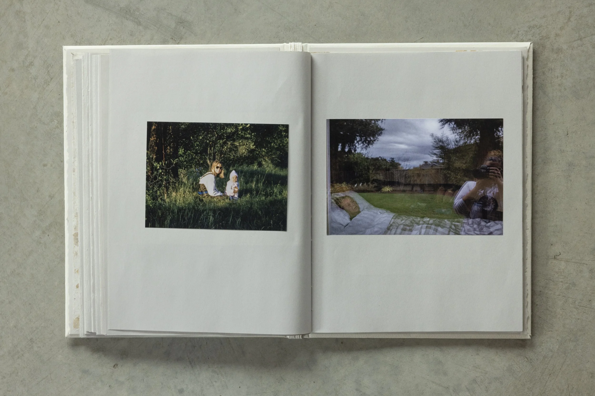 An open photo album displaying two photographs, one of a woman and child in a grassy outdoor setting, and the other of a person lying in bed outdoors with cloudy sky and trees in the background.