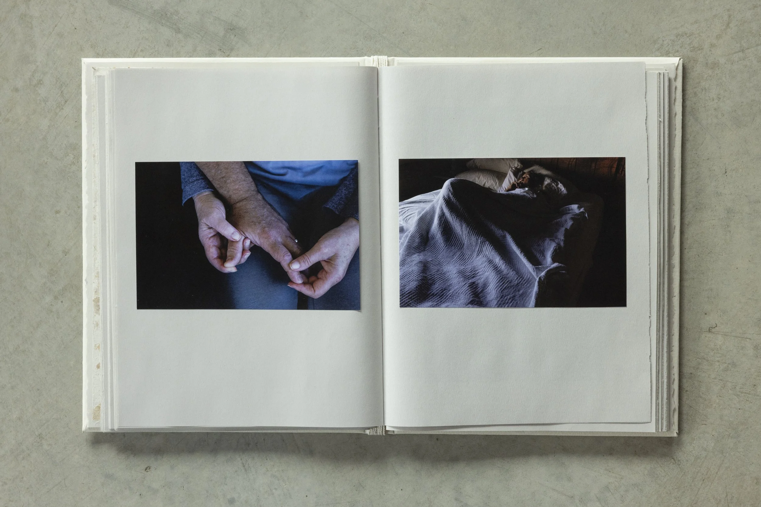 Open photo album on a gray surface displaying two photographs: one of two hands holding each other, another of a person resting in a bed.