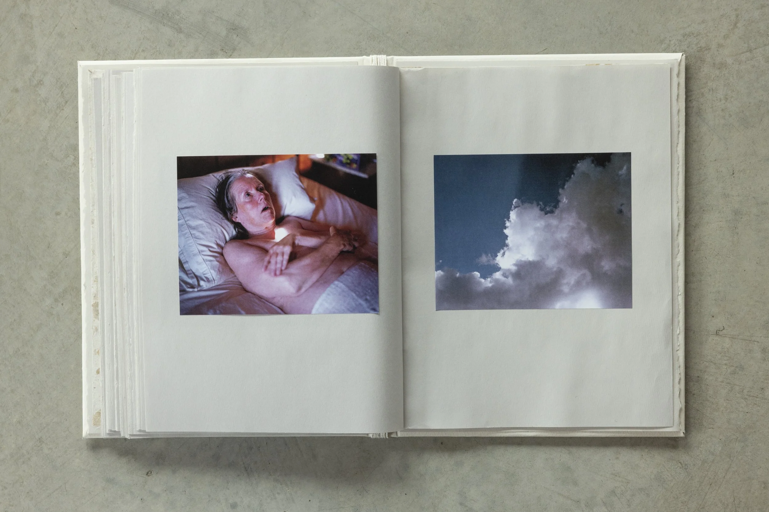 Open photo album with two visible pages showing images of a woman in bed and a cloudy sky.