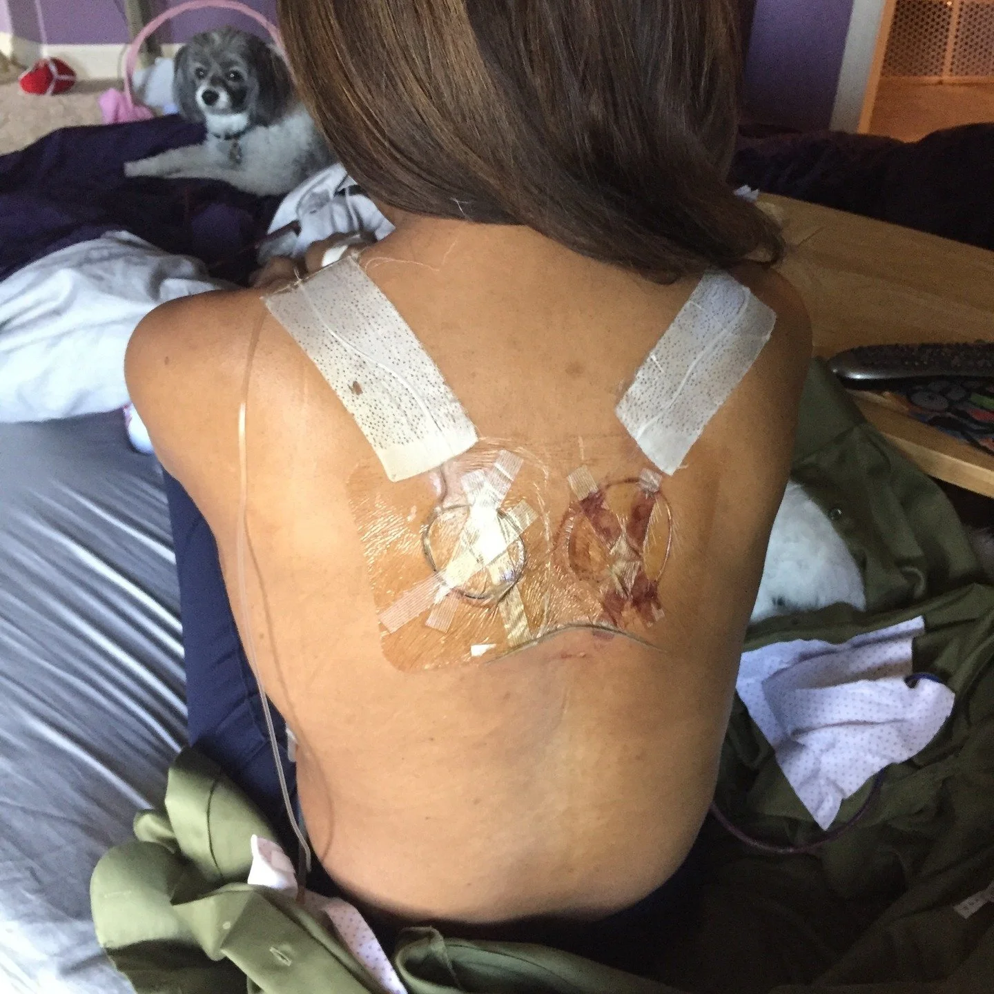 Sometimes we think healing means &ldquo;going back&rdquo; to who we were before the breaking.
But there is no returning.
Only becoming.

And maybe the courage was never about being unscarred&hellip;
but about choosing to live fully in the body that r