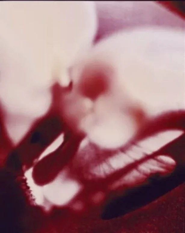 POSTPARTUM GARDEN by Johnny Mae Hauser &amp; Aldo van Den Broek