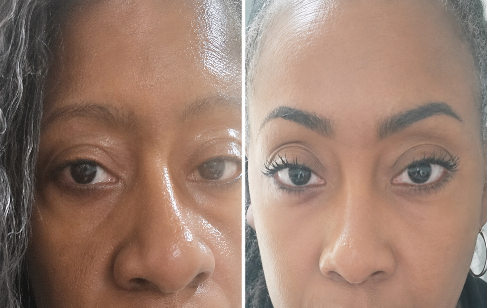 Dark Eye Cir Before_After Aug 4, 2026, 04_51_16 PM.png