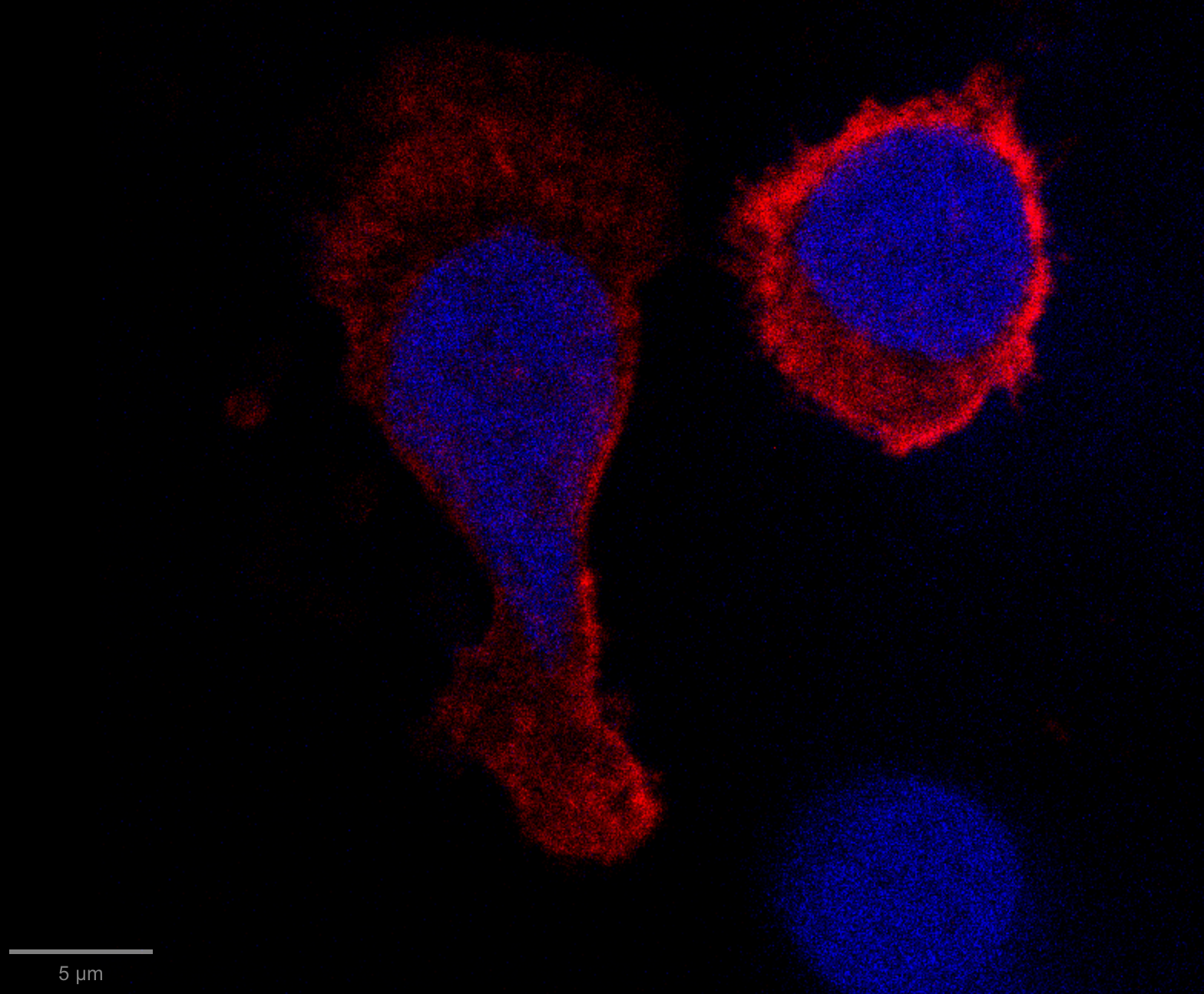 Microscopy of authentic reservoir clones with blue and red fluorescence. Image: Jones Lab.
