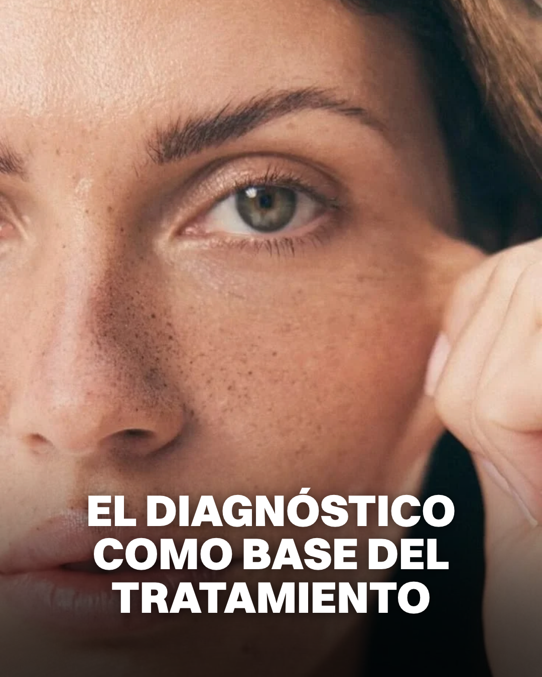 Por qué para mí el diagnóstico importa más que el tratamiento en la flacidez facial