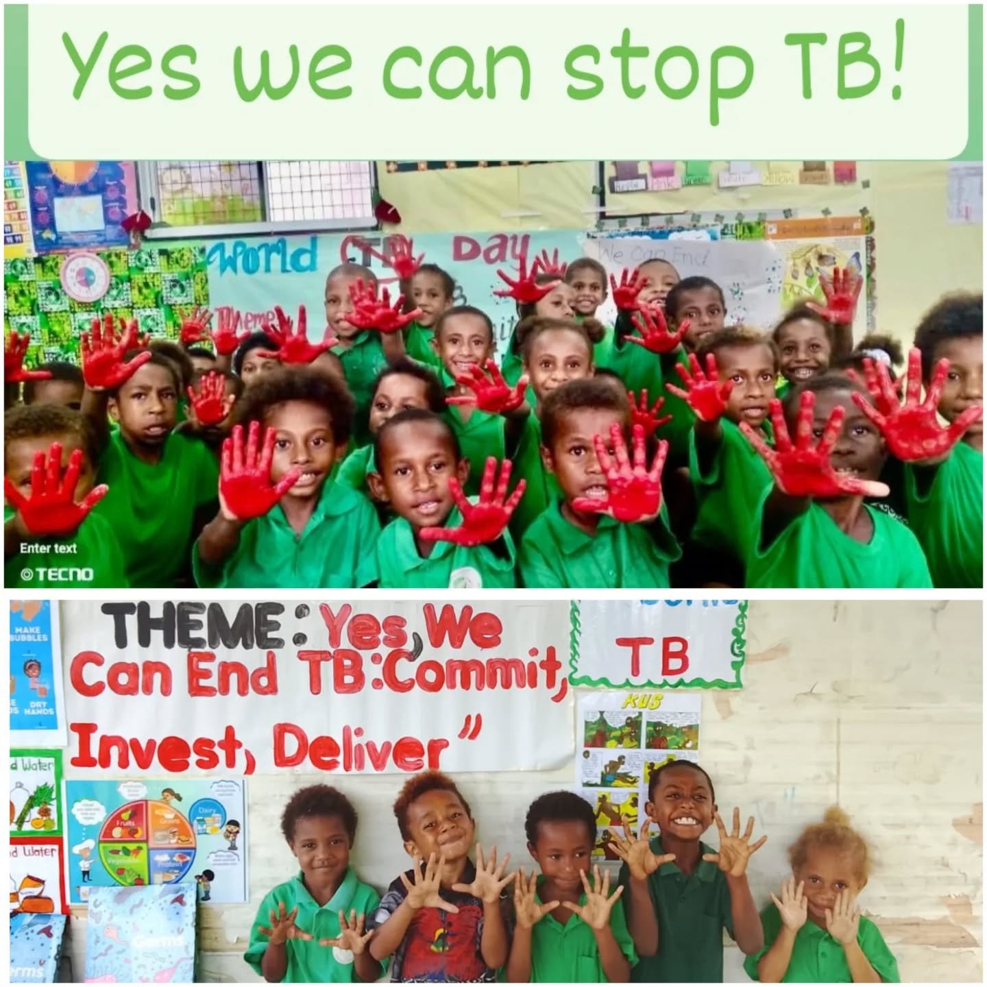 🌍❤️ Happy World TB Day ❤️🌍
Today, all our libraries marked World TB Day by raising awareness about Tuberculosis (TB) in a fun, simple, and meaningful way for our children.

TB is a serious but preventable and curable disease, and it remains a conce