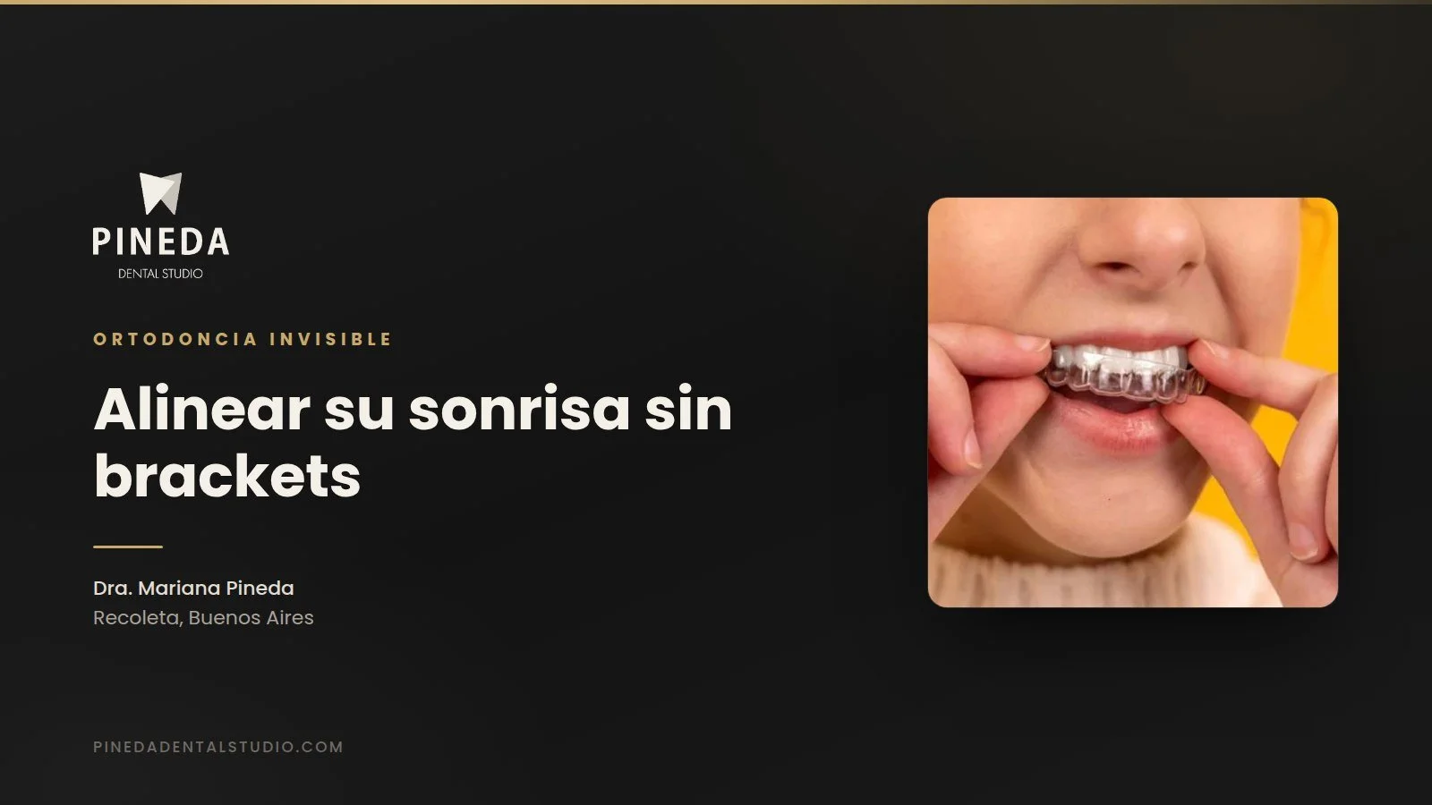 Ortodoncia sin brackets: cómo alinear tu sonrisa sin alterar tu estilo de vida