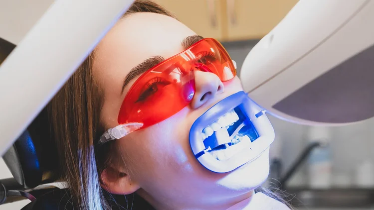 Tratamiento profesional de blanqueamiento dental con luz LED a una paciente en Pineda Dental Studio.