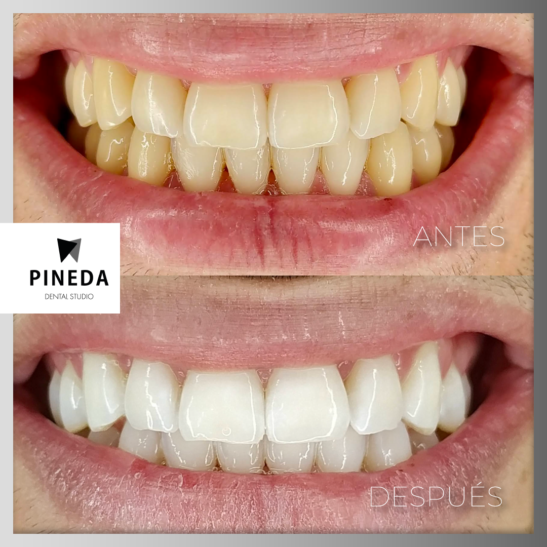 Pineda Dental Studio