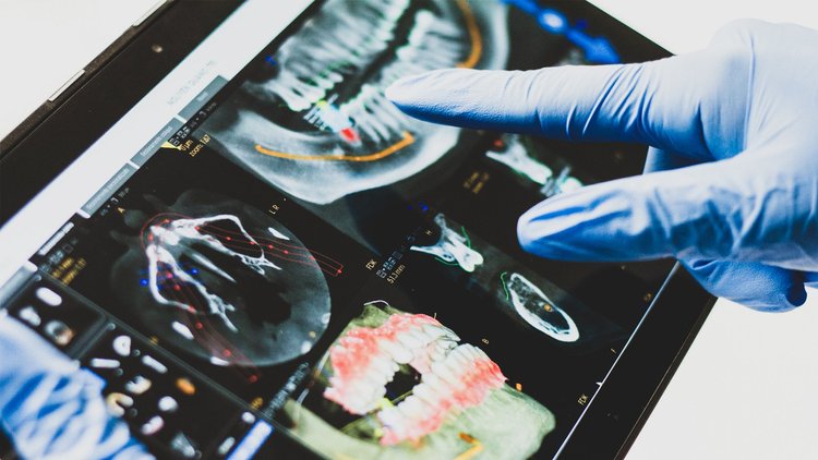 Cirujano maxilofacial analizando una tomografía dental 3D para planificar una intervención segura en Pineda Dental Studio, Recoleta.