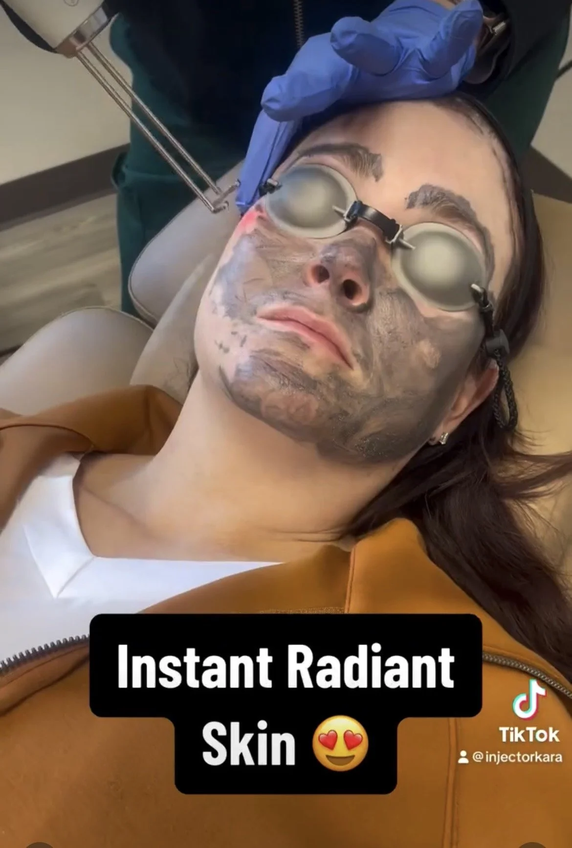 Reveal Clear, Glowing Skin with the Natura™ Laser Peel