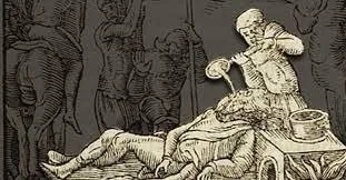 Pouring molten metal onto the face of a criminal