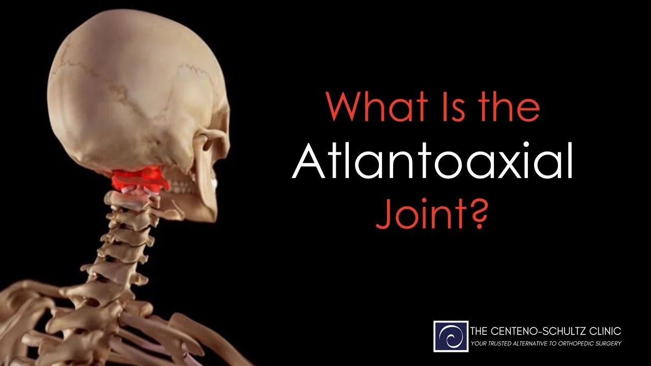 what-is-the-atlantoaxial-joint.jpg
