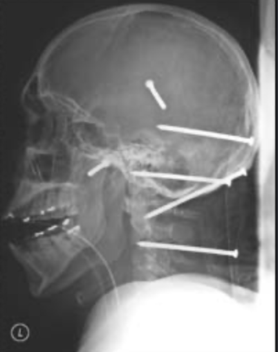 Isidro Mejia, nail gun