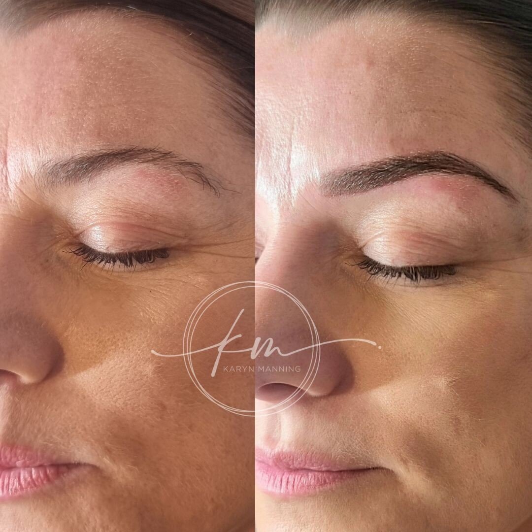 LOVE the definition and framing of the face with #combinationbrows for @lovingmrsgriff 💥
Never underestimate the difference a well proportioned #brow can make! Each individuals facial features, and natural brow hair is taken in to consideration to a