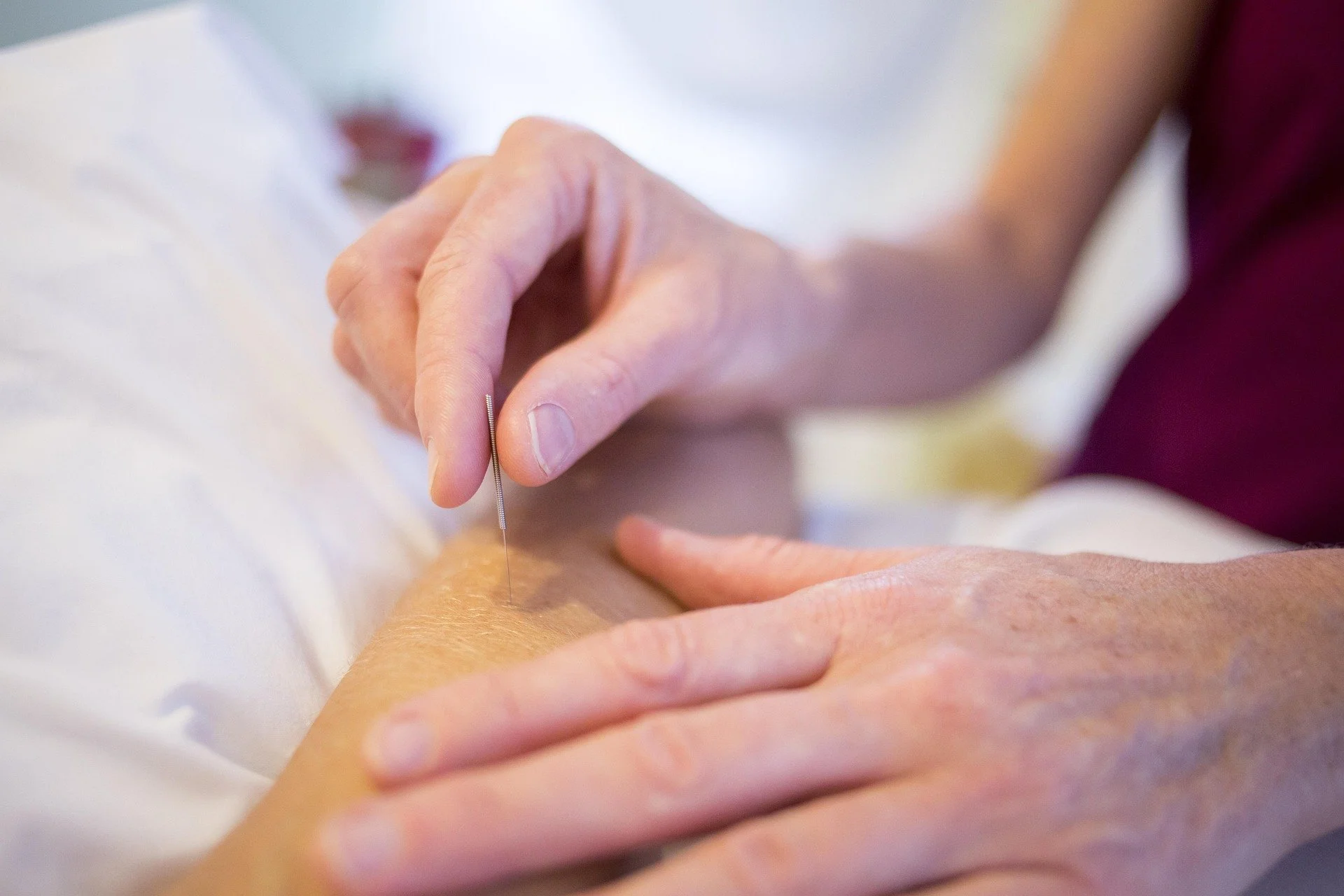 Acupuncture and Resilience 