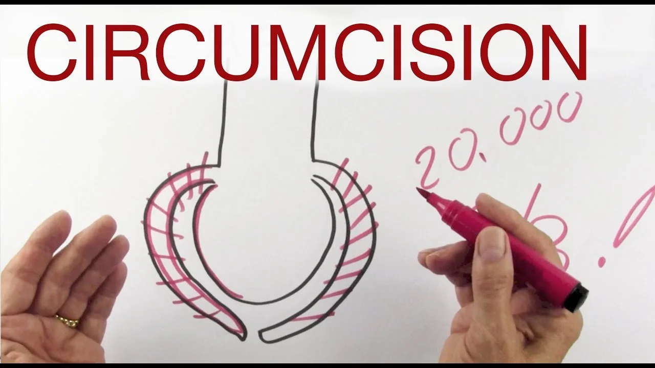 Circumcision