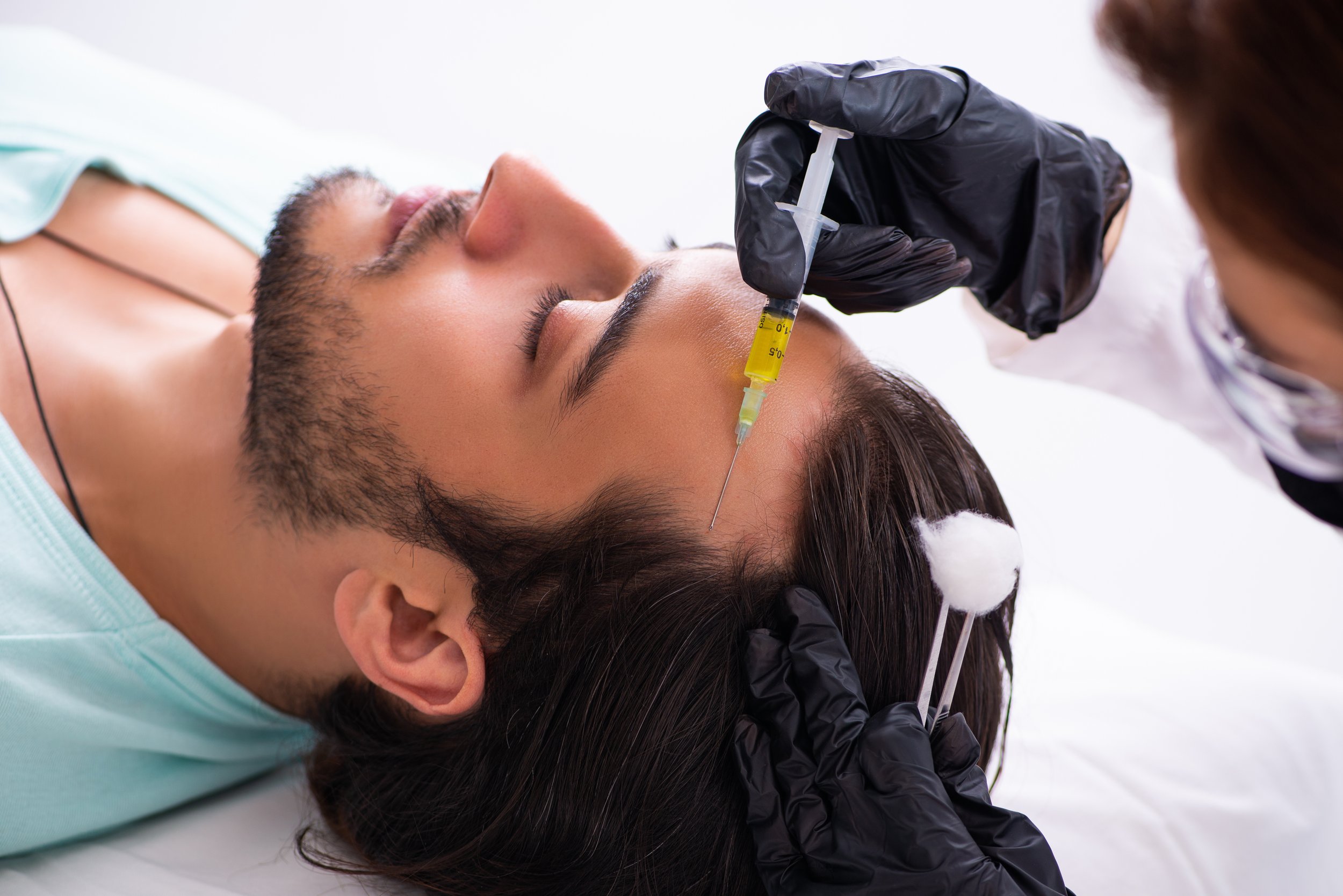 Does PRP really work for hair loss?