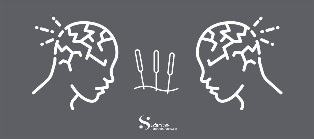 Treating Pandemic Stress and Pain with Acupuncture