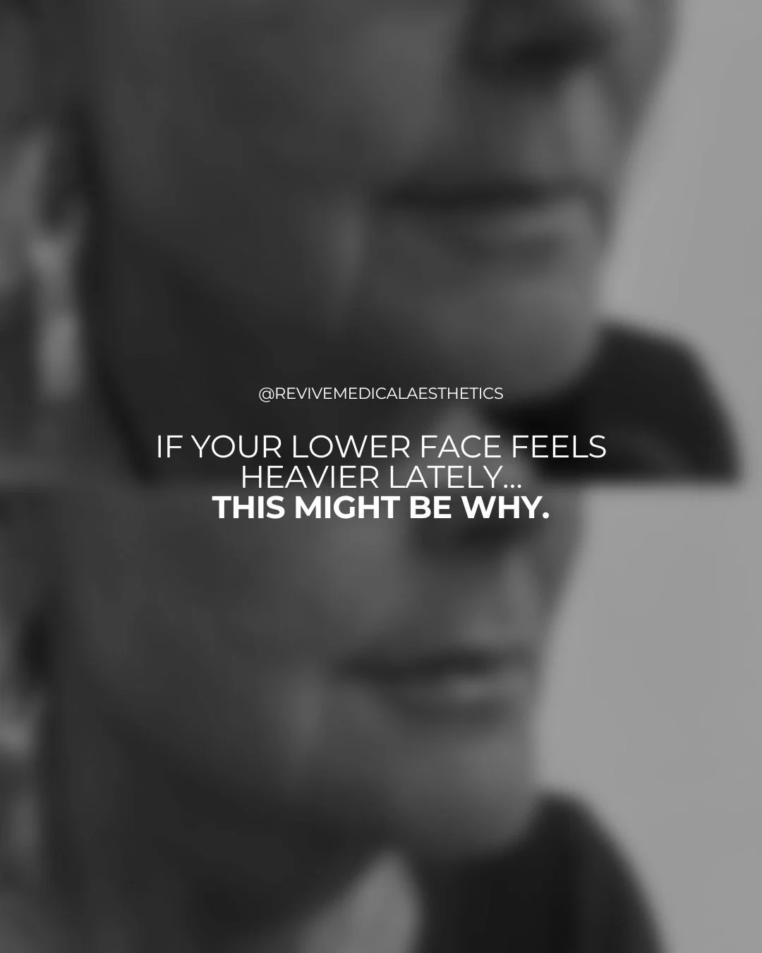 This is such a fun treatment to take a closer look at 👉🏼

If you&rsquo;ve ever felt like your lips look a little flat or dehydrated, or that the lower part of your face feels slightly out of balance, small amounts of dermal filler can sometimes hel