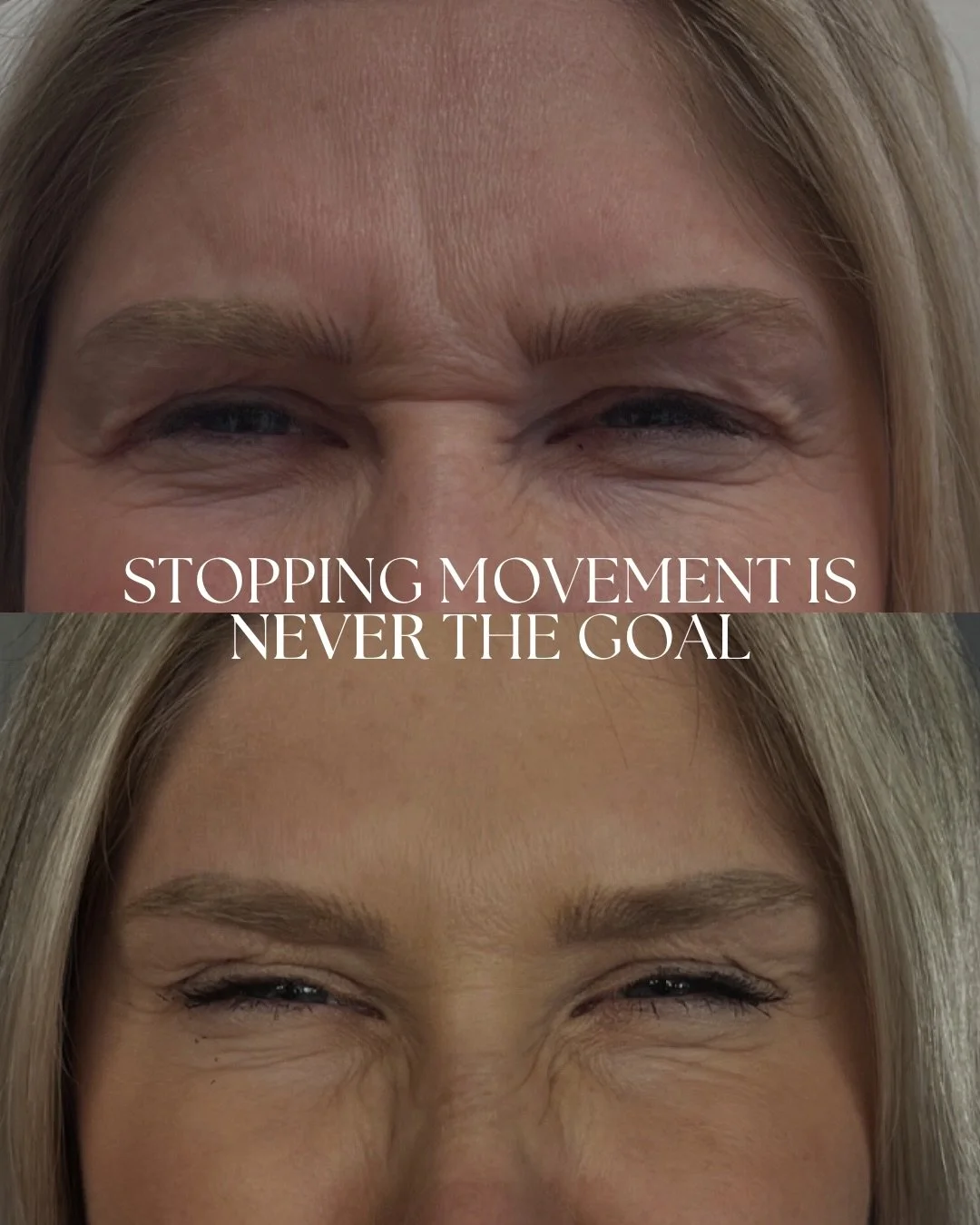 If you&rsquo;re worried about freezing your entire face or not being able to give your man that &ldquo;look&rdquo; when he forgets to pick up your sweet treat on the way home, you&rsquo;ve come to the right place. 🙂&zwj;↕️🤝🏼

Let&rsquo;s talk abou