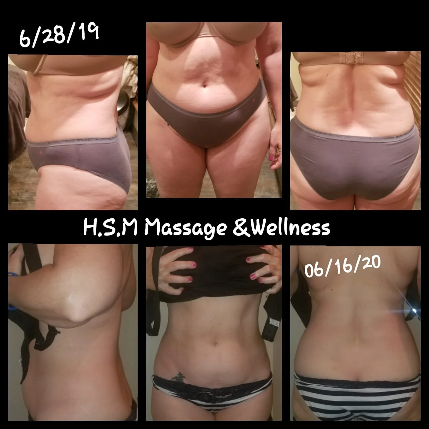 a year with Cryoskin.jpg