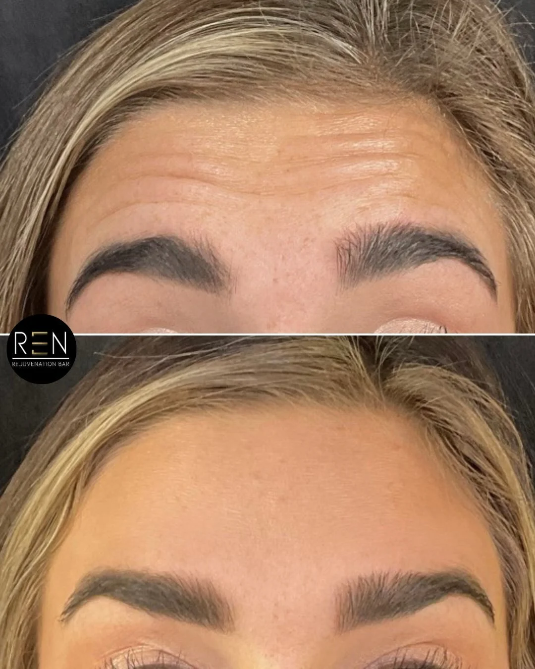 Dear Santa,
Wishing for a smooth forehead for Christmas ✨

Book a free consultation online at renrejuvenationbar.com

[wrinkle relaxer, botox treatment, letybo, dysport]