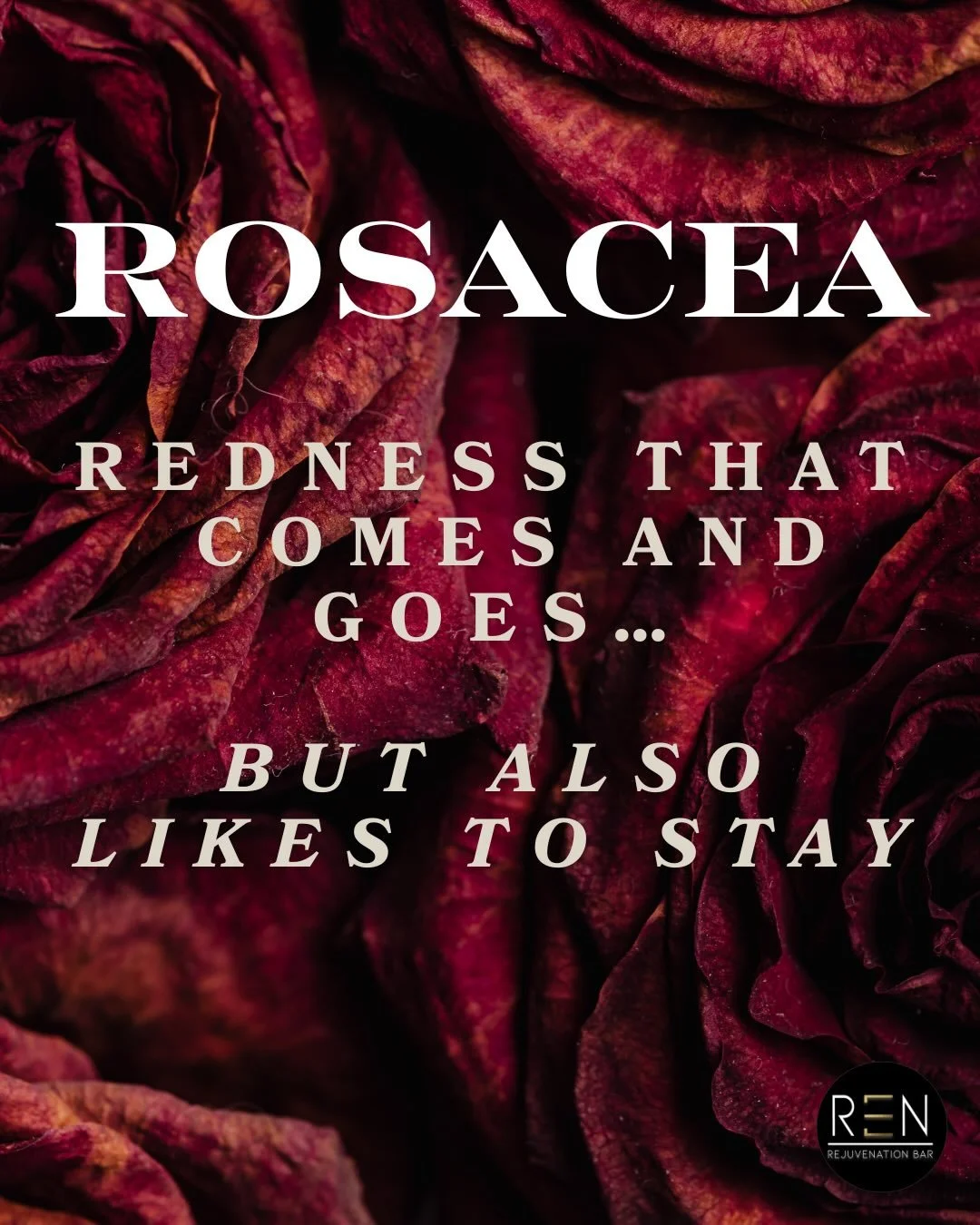 Rosacea isn&rsquo;t &ldquo;just sensitive skin.&rdquo; 

It&rsquo;s a chronic inflammatory condition that loves to flare when your skin gets overheated, overstressed, over-scrubbed, or over-exfoliated. (And yes&hellip; sun, spicy food, alcohol, and h
