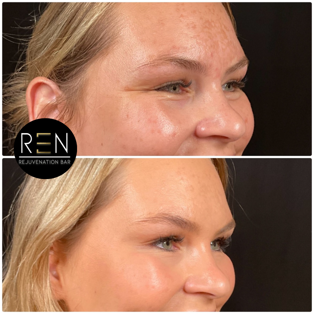 Jelly roll tox - 3.PNG