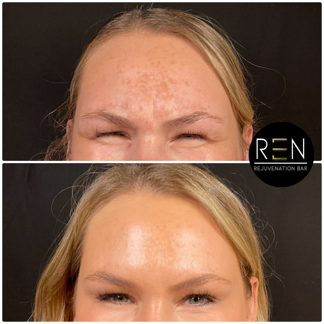 Jelly roll tox - 5.PNG