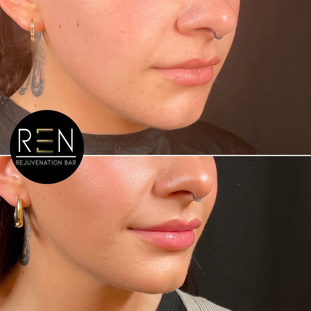 C3535D1E-AC4A-4A19-B4BC-850282000D0E 2.PNG