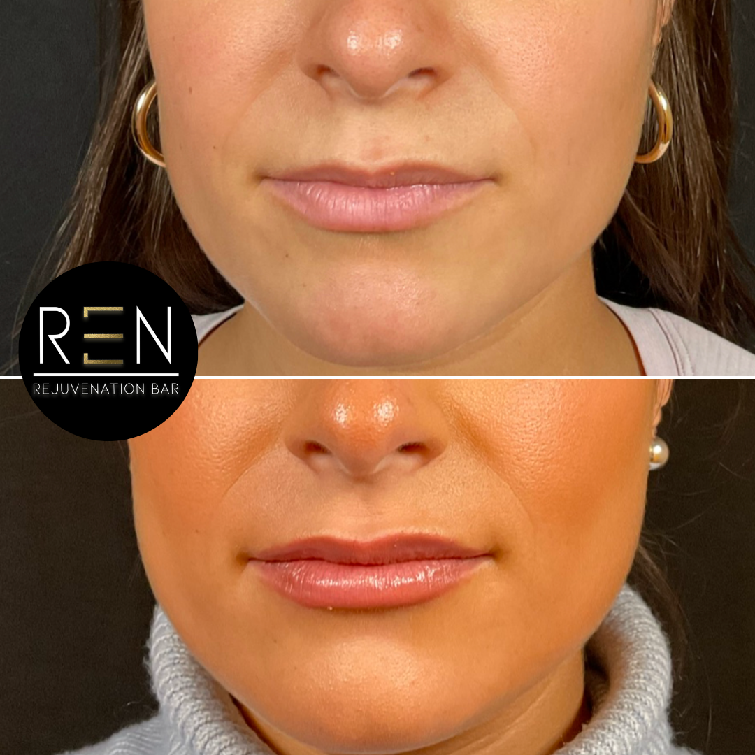 Untitled design - 23.PNG