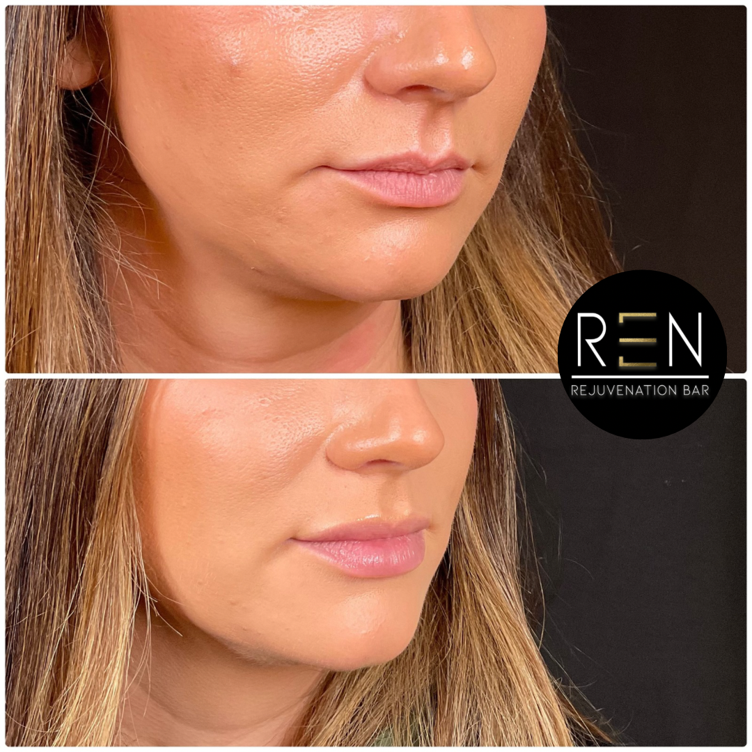 Untitled design - 31.PNG