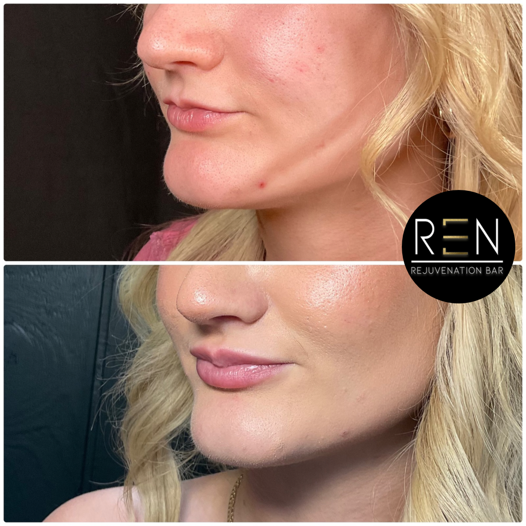 Untitled design - 34.PNG