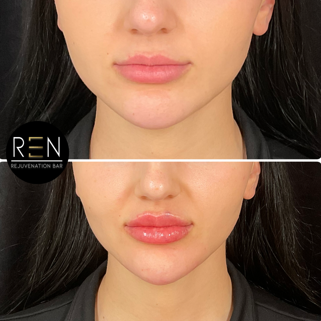 Untitled design - 36.PNG