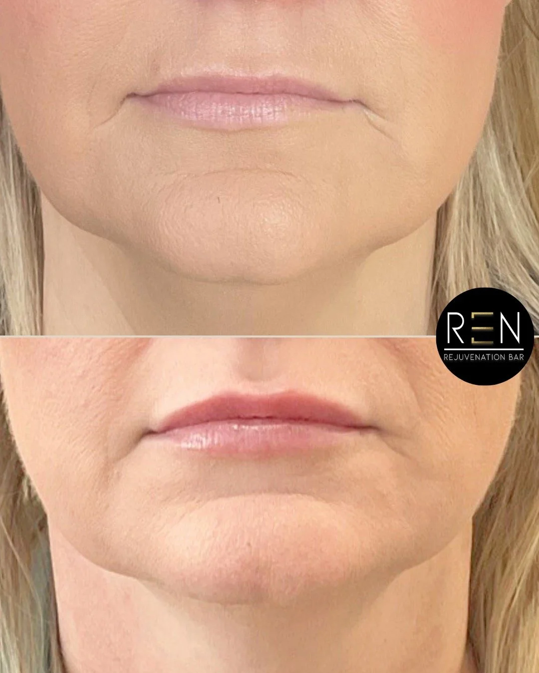 Untitled design-3 2.JPEG