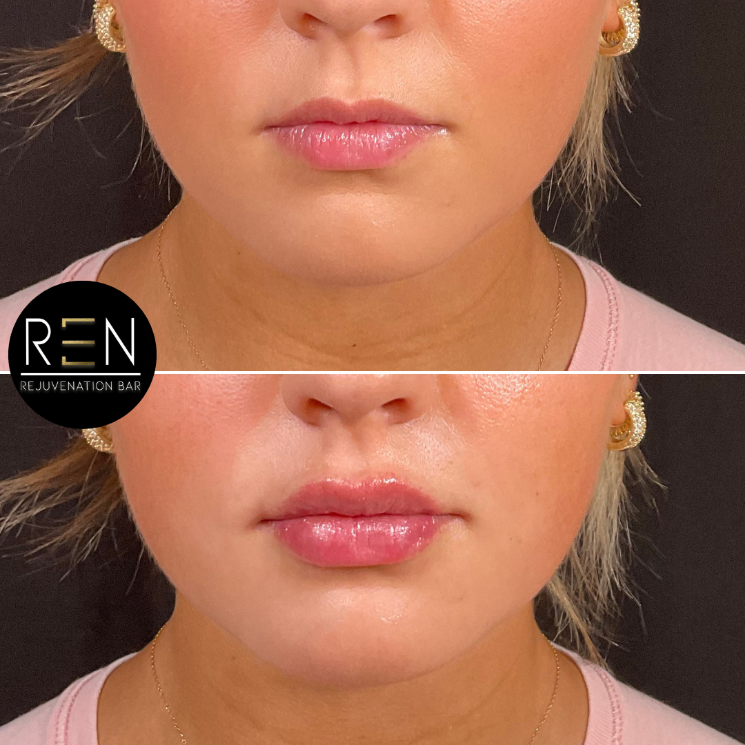 Untitled design.zip - 17.PNG