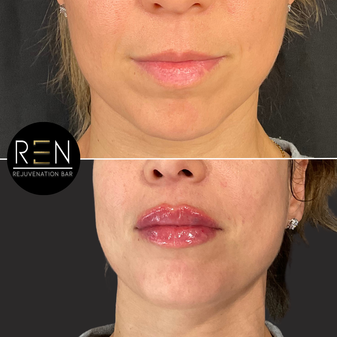 Untitled design.zip - 25.PNG