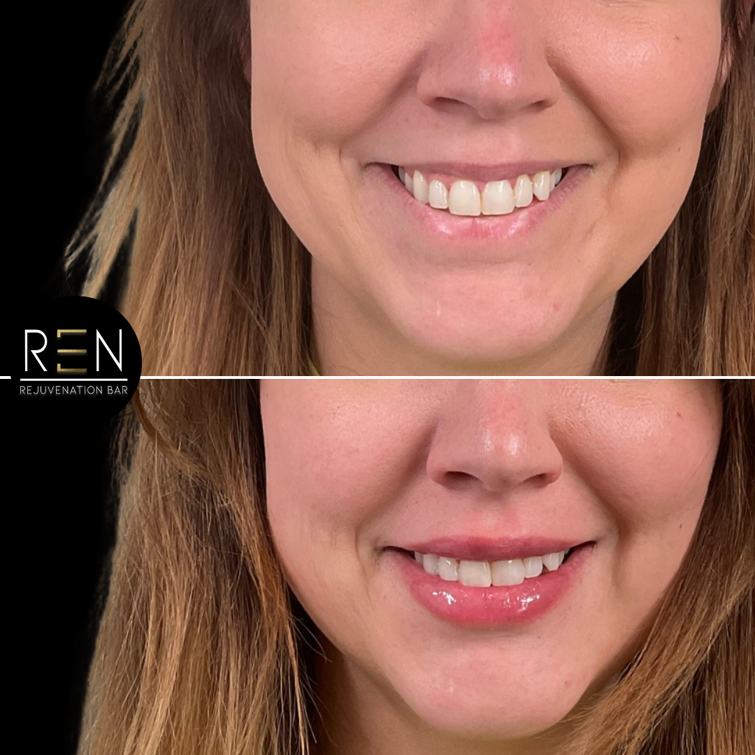 Untitled design.zip - 24.PNG