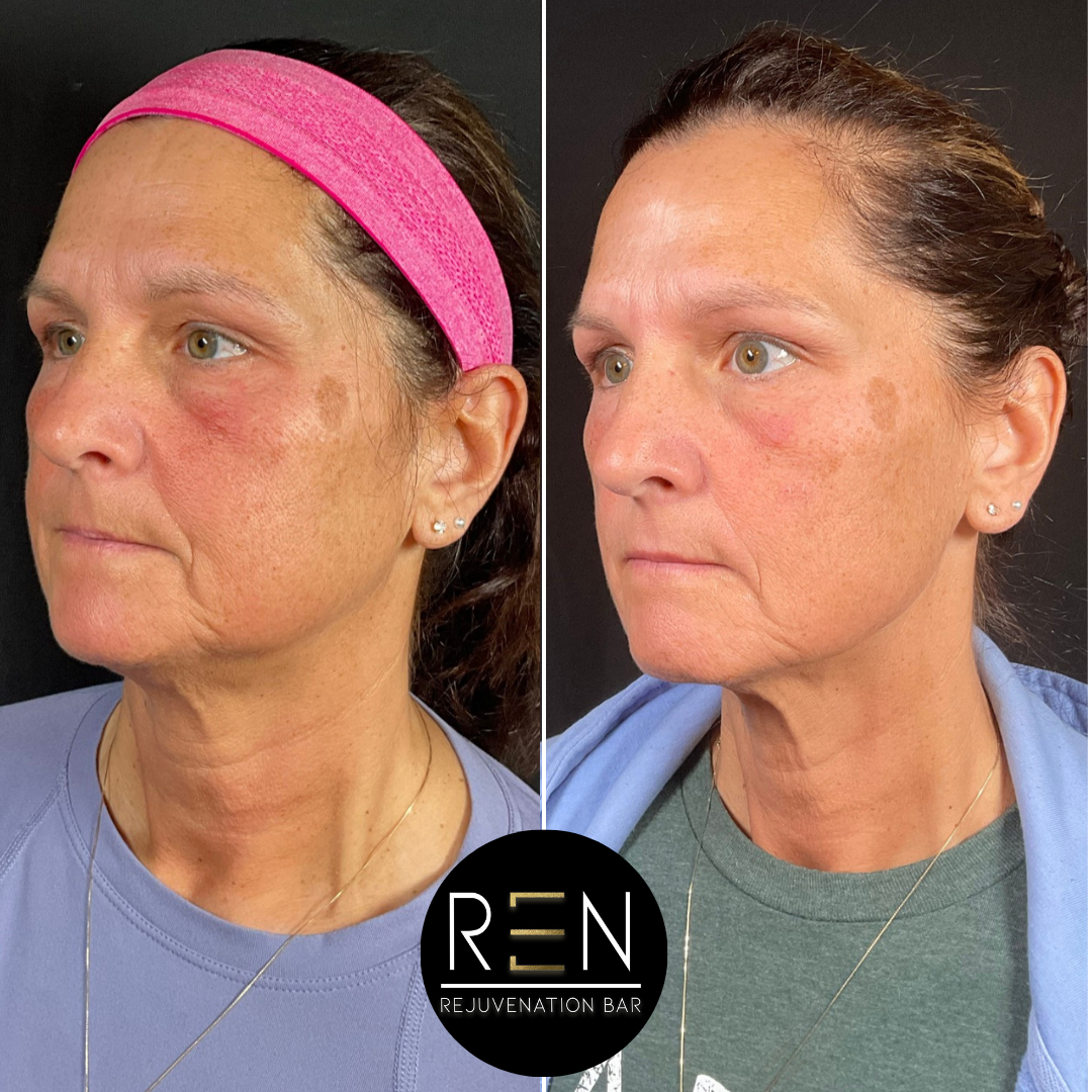 Masseter Tox + Medical Grade Skincare.zip - 5.PNG