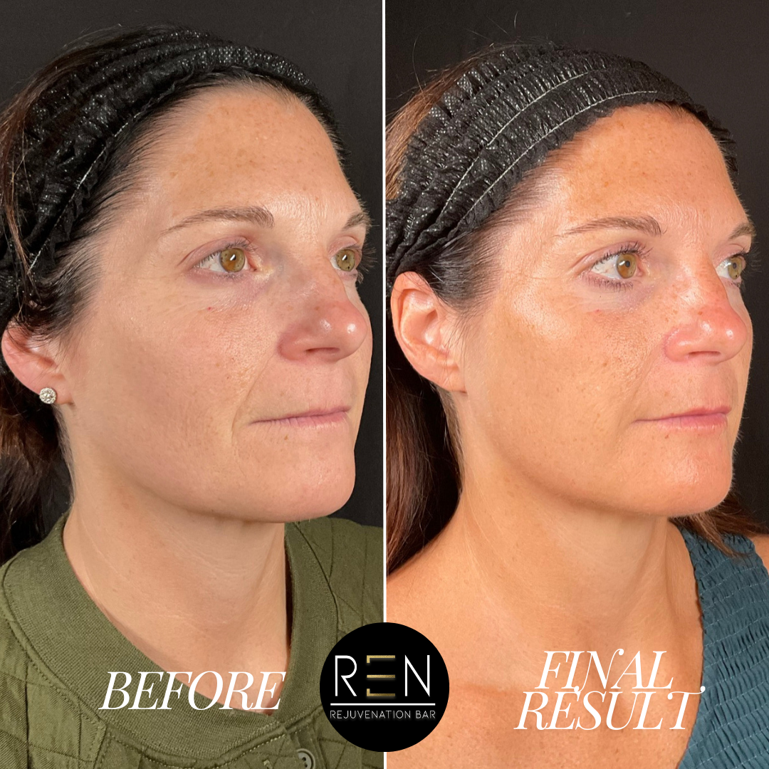 Copy of Copy of B & A Kate Michinski.zip - 10.PNG