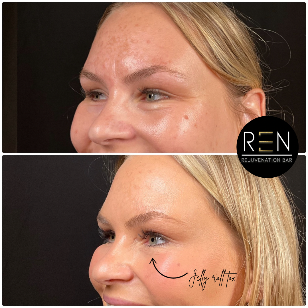 Jelly roll tox - 2.PNG