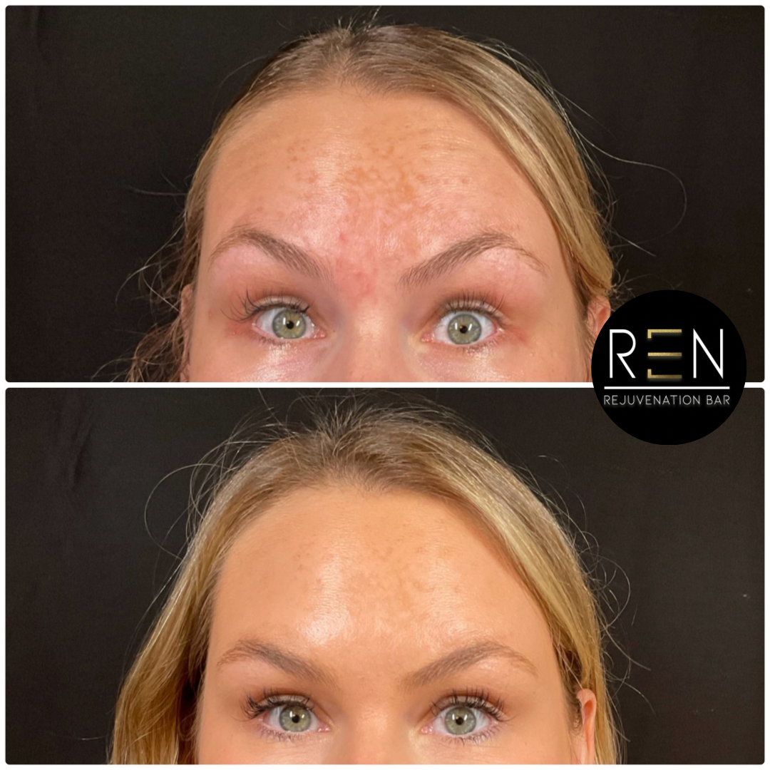 Jelly roll tox - 4.PNG