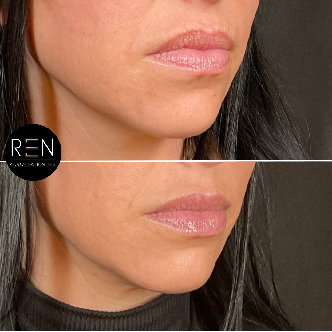 Untitled design.zip - 19.PNG